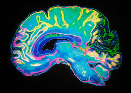 How Pornography Affects Your Brain [is porn good for you?]